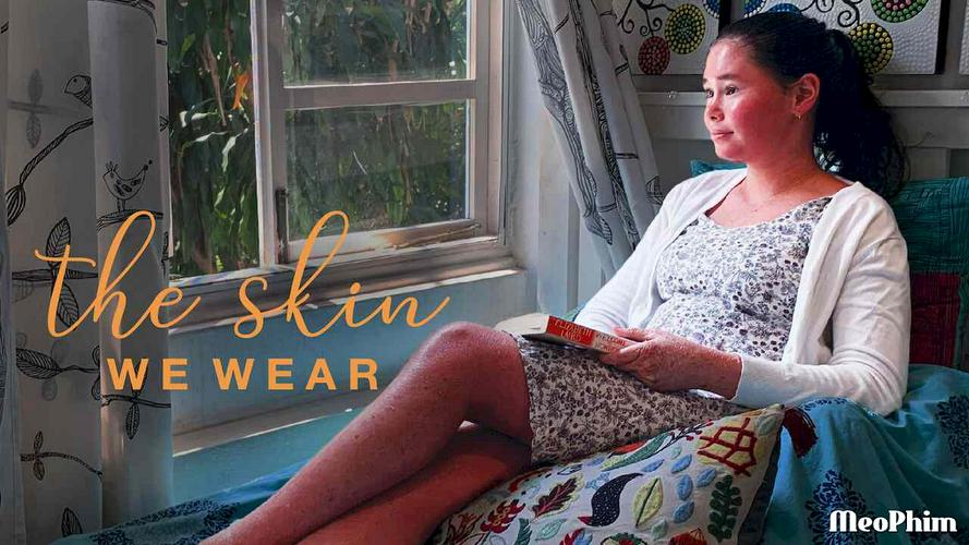 Tập Full Lớp vảy tôi mang